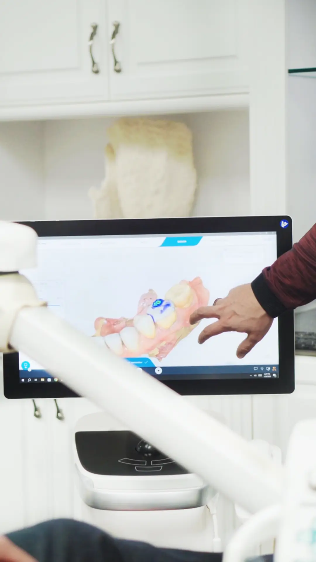 portada de video de extracción segura de amalgamas en Dental Expressions, experiencia de paciente