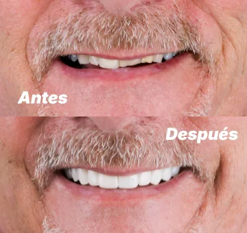 Coronas el mismo día en San Diego antes y después