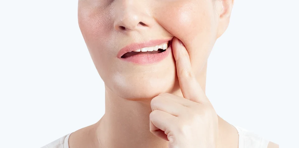 Diente posterior fracturado