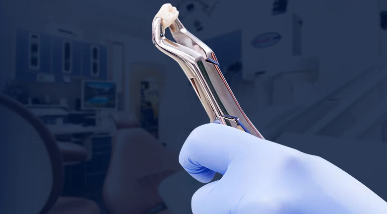 Mano de dentista sosteniendo una pinza con un diente extraído