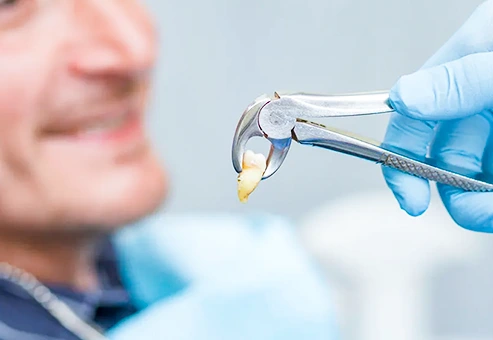 Fabricación de soluciones dentalespersonalizadas, proceso de personalizacion dental