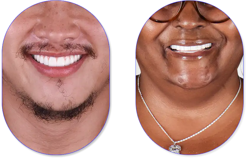 Pacientes masculino y femenino felices después de realizarce su tratamiento de implantes dentales en Dental Expressions