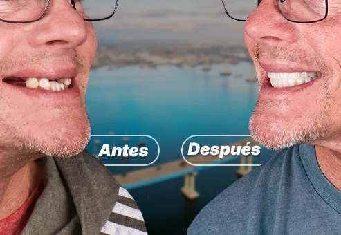 Fabricación de soluciones dentalespersonalizadas, proceso de personalizacion dental