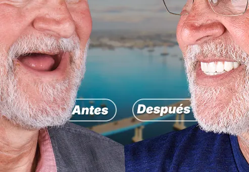 Fabricación de soluciones dentalespersonalizadas, proceso de personalizacion dental