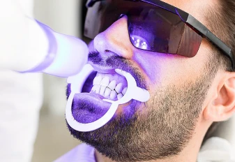 Blanqueamiento dental con tratamiento ZOOM de 2 sesiones en San Diego
