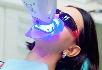 Blanqueamiento dental con tratamiento ZOOM en 3 sesiones en San Diego