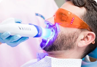 Blanqueamiento dental con tratamiento ZOOM en 1 sesión en San Diego